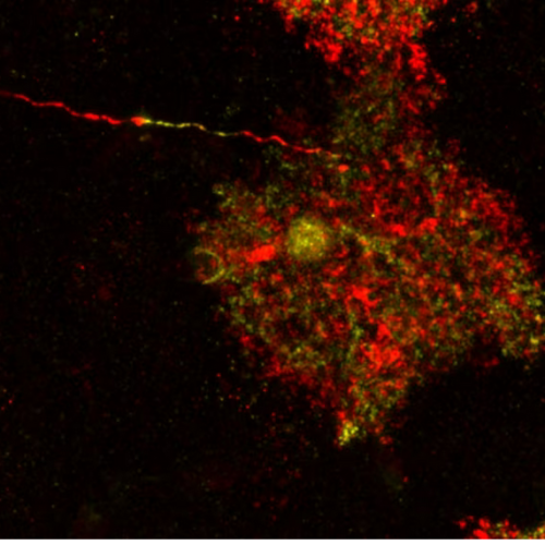 Científicos del CSIC descubren que células cerebrales consideradas inofensivas están vinculadas a enfermedades neurológicas