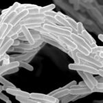 Expertos internacionales se reúnen en Jaca para combatir la tuberculosis y otras infecciones por micobacterias