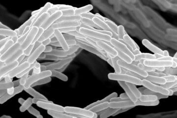 Expertos internacionales se reúnen en Jaca para combatir la tuberculosis y otras infecciones por micobacterias